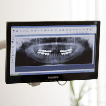 digital dental xray